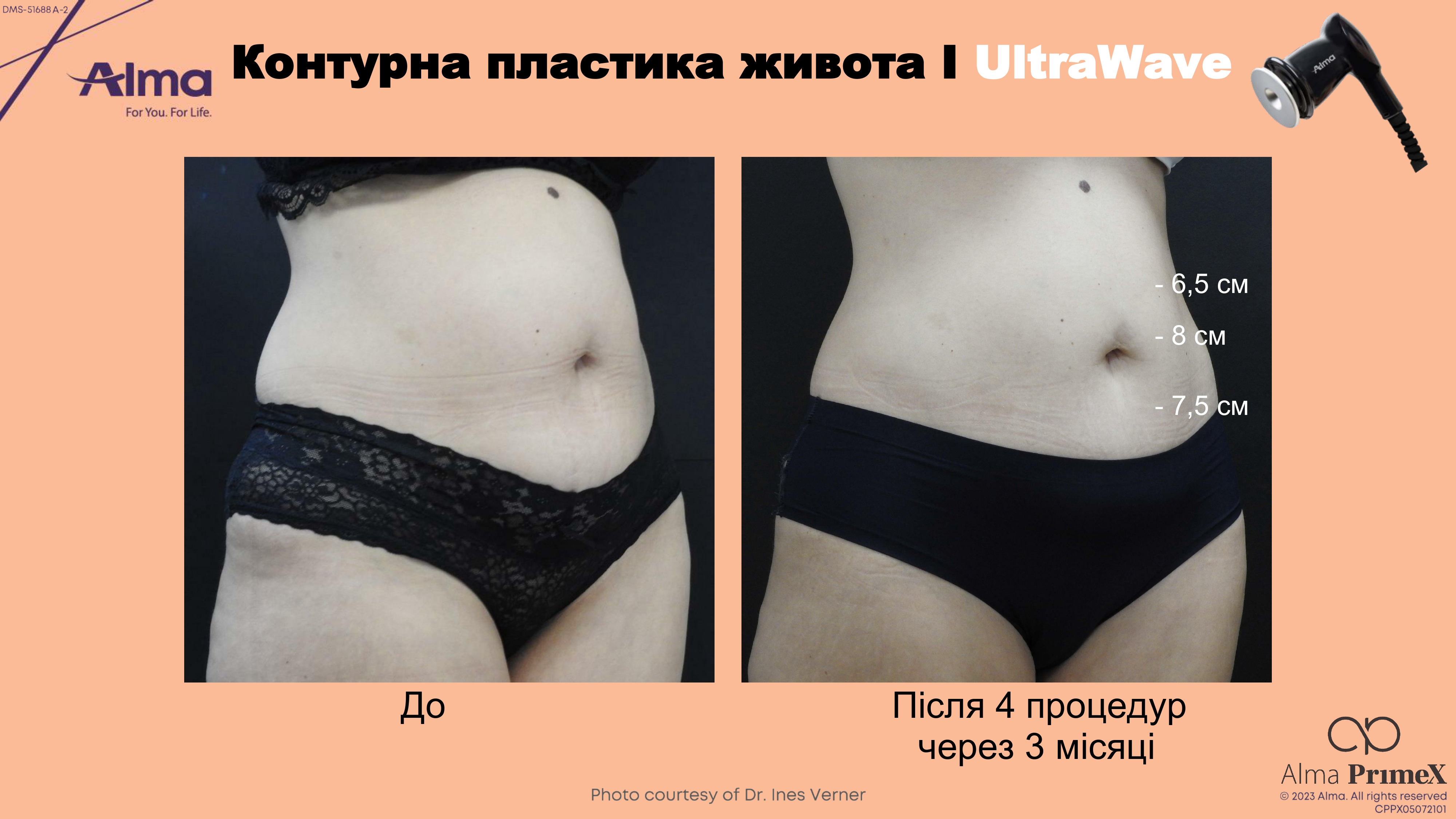 main-slider-img
