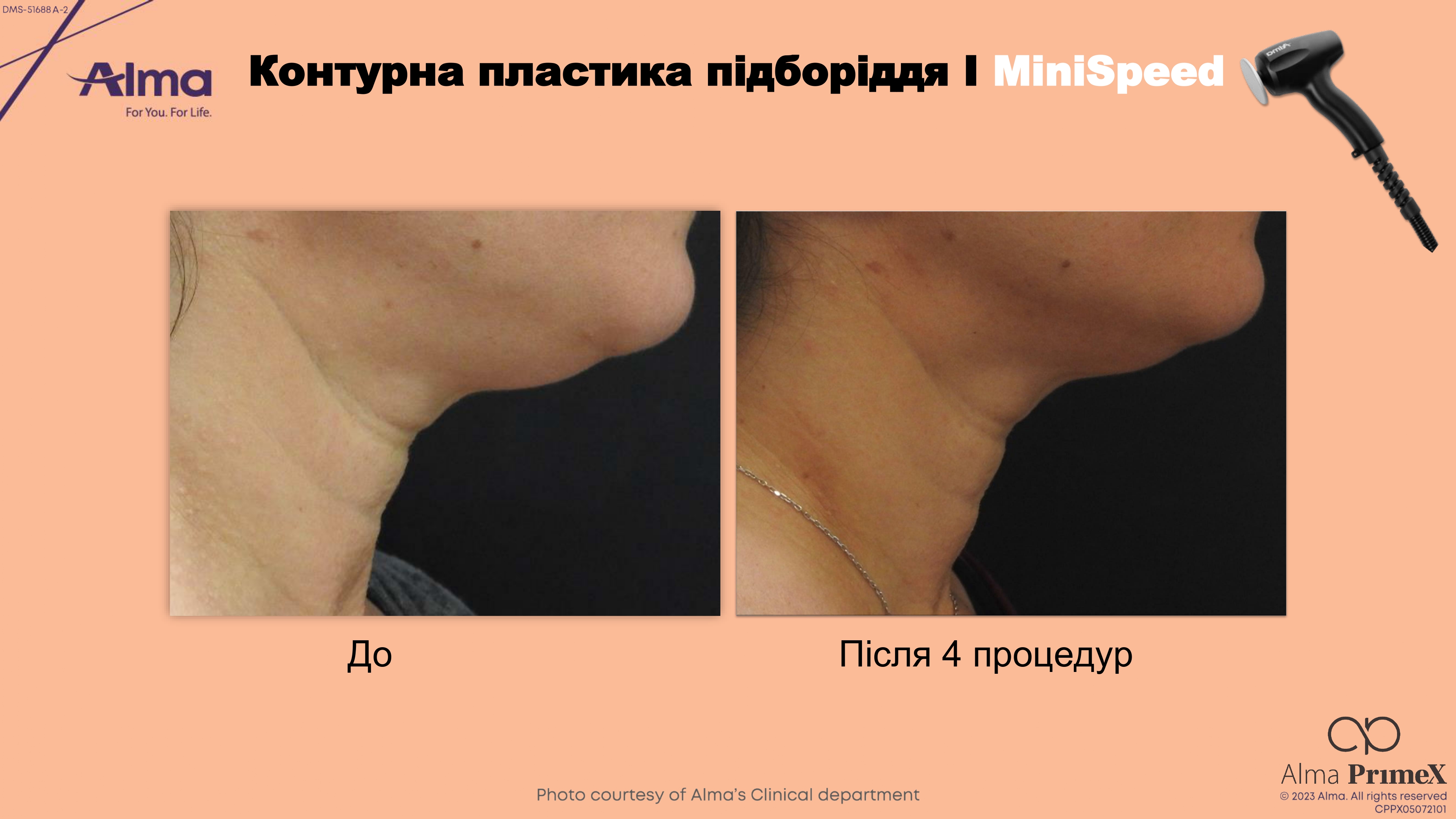 main-slider-img